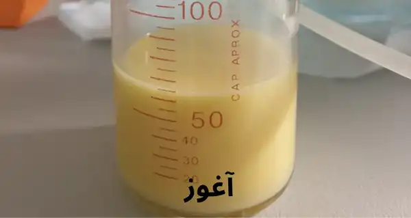 عوارض اغوز خیراندیش در طب سنتی برای مردان و زنان